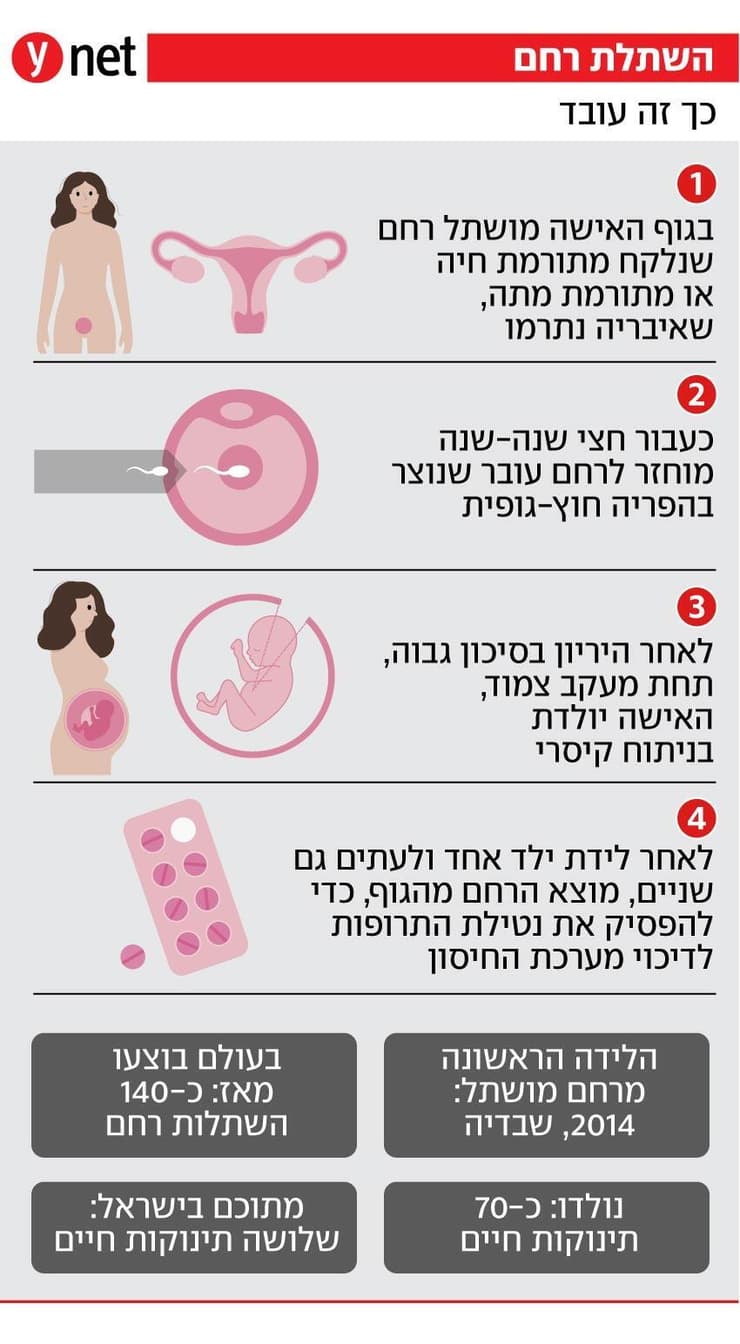 אינפו השתלת רחם
