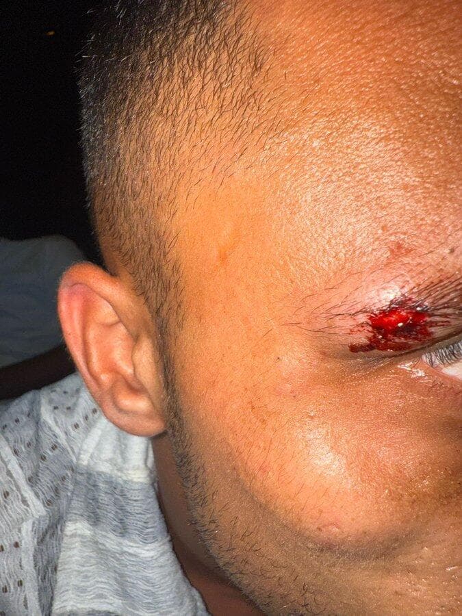 הישראלים שהותקפו