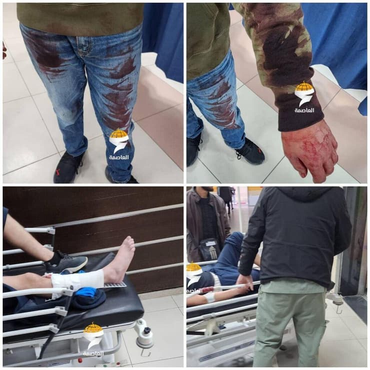 ארבעה פלסטינים פצועים