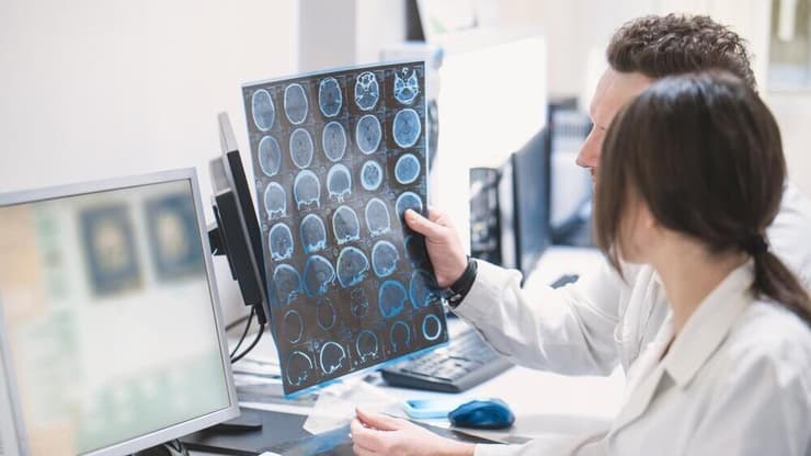 אלצהיימר, מוח, דמנציה