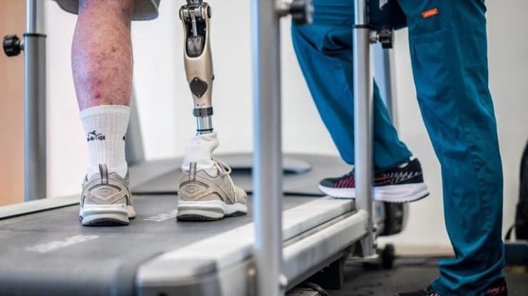 שיקום קטוע רגל בעדי נגב, נחלת ערן (צילום: יעקב דניאל) שיקום קטוע רגל בעדי נגב, נחלת ערן