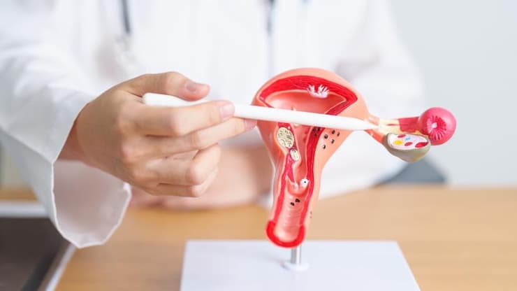 סרטן השחלות