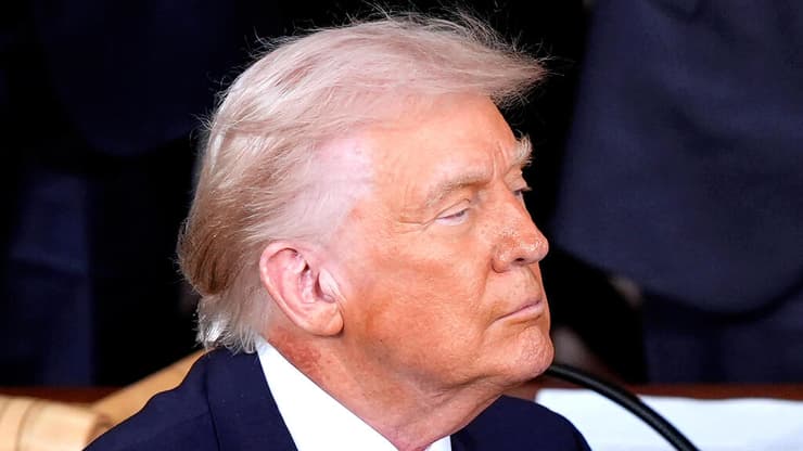 גם בהופעה מול הקונגרס בחודש שעבר בלטה אותה פריחה, אך נראה שהחמירה מאז (צילום: AP Photo / Mark Schiefelbein) נשיא ארה"ב דונלד טראמפ סובל מפריחה בעור, צולם ב-24.2