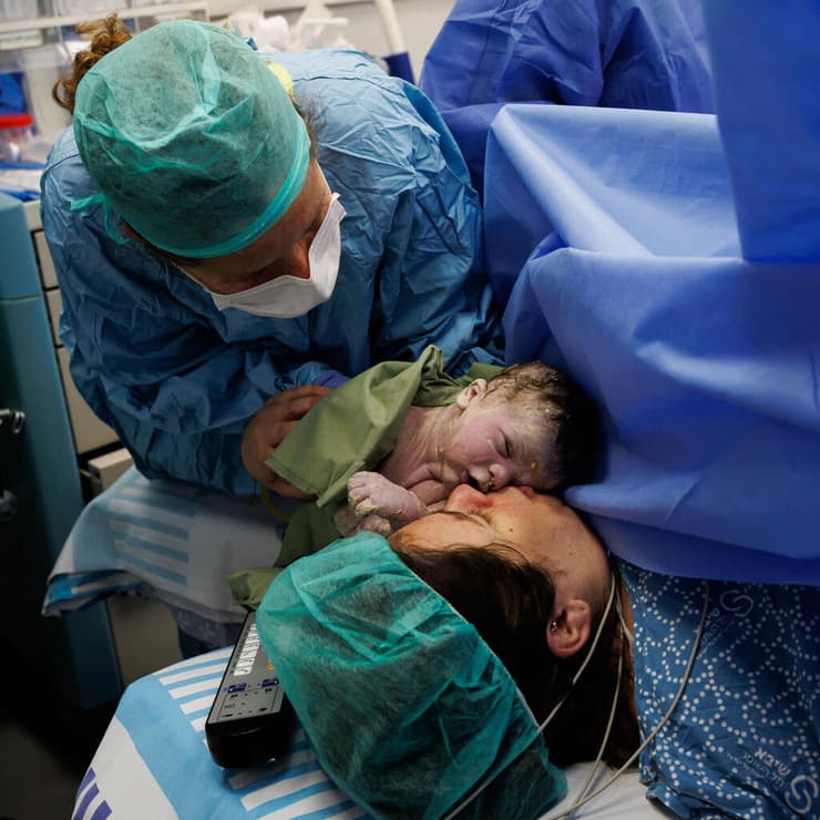 לידה במהלך מלחמת שאגת הארי בשיבא. בתמונה: ניתוח קיסרי של עדי שטרית אהבתי