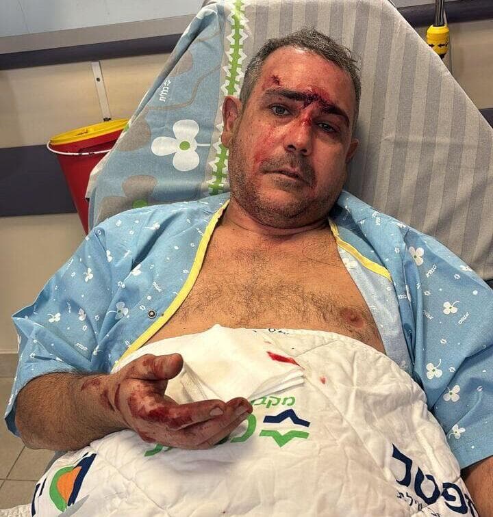 בן אביטל. פצוע קל מאושפז ביוספטל