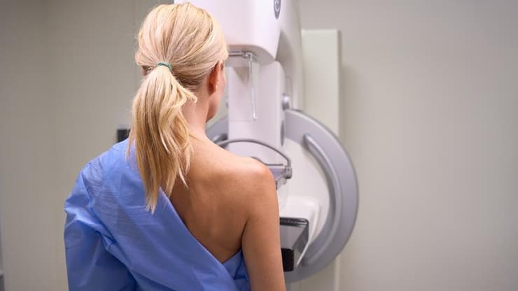 בדיקת ממוגרפיה לגילוי סרטן השד
