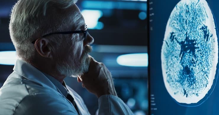 הדמיה מוחית מתקדמת (צילום: shutterstock) ct מוח הדמיה