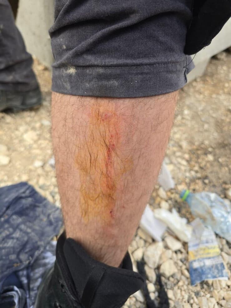 עימותים אלימים בין שוטרים לחרדים בירושלים