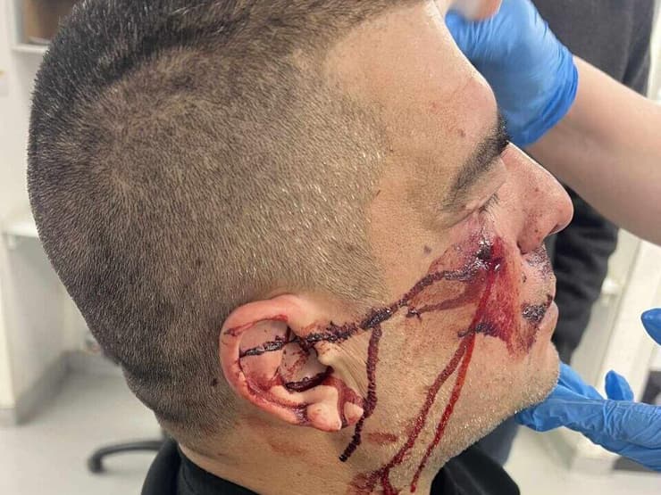 נהג האוטובוס עלי מוסא תושב מזרח ירושלים שהותקף