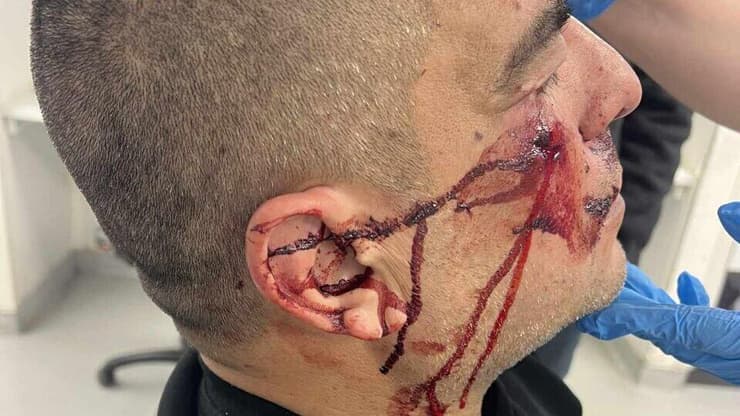 "שום דבר לא נעשה", מוסא נהג האוטובוס עלי מוסא תושב מזרח ירושלים שהותקף