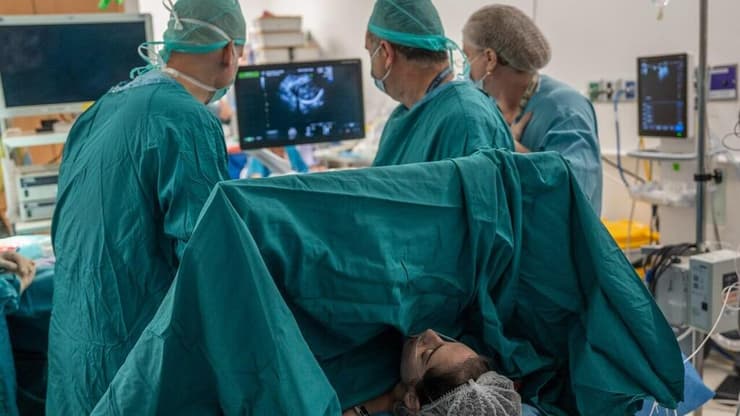 הרופאים ניתחו את העובר בחדר הקרינה (צילום: דוברות בילינסון) העובר של מיכל אזולאי נותח בחדר הקרינה במרכז דוידוף בבית החולים בילינסון