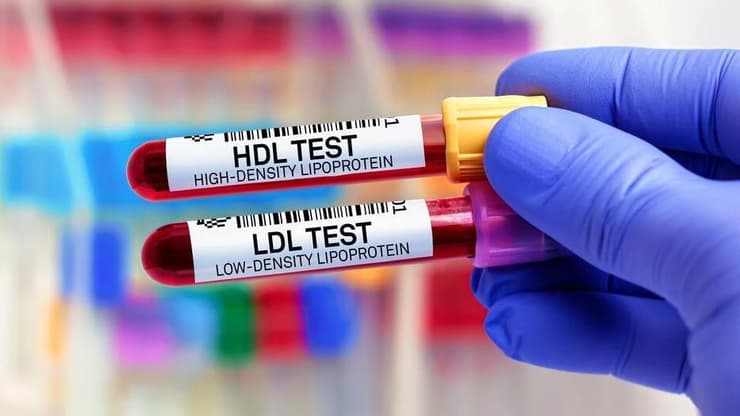 כולסטרול, בדיקת דם LDL