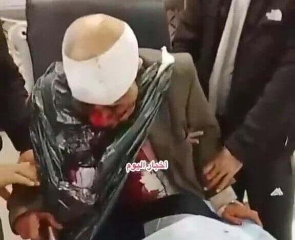 פלסטיני שהותקף על ידי מתנחלים בתיאסיר