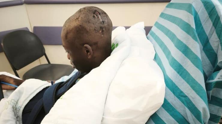 עיסא. "הוא לא אותו ילד כמו שהיה קודם" עיסא בן ה-12 נער סודני נפצע באורח בינוני מ שברי יירוט ב אילת עיר מגוריו