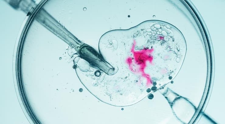 הפריה חוץ גופית