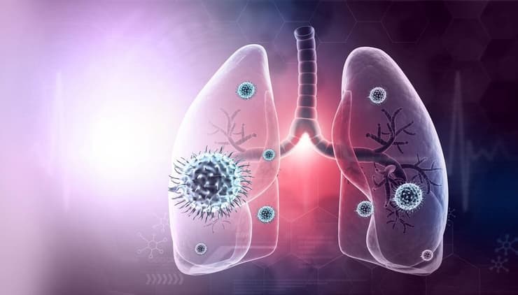 ריאות, קורונה