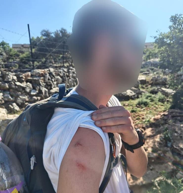 פציעות המטיילים שדיווחו על זריקת אבנים בדיר דבואן