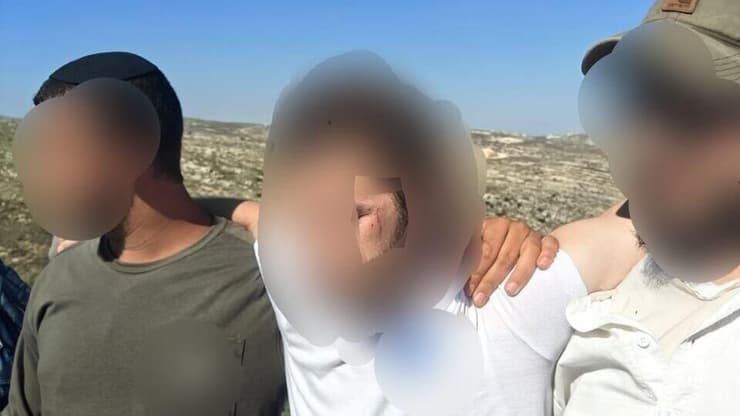 פציעות המטיילים שדיווחו על זריקת אבנים בדיר דבואן