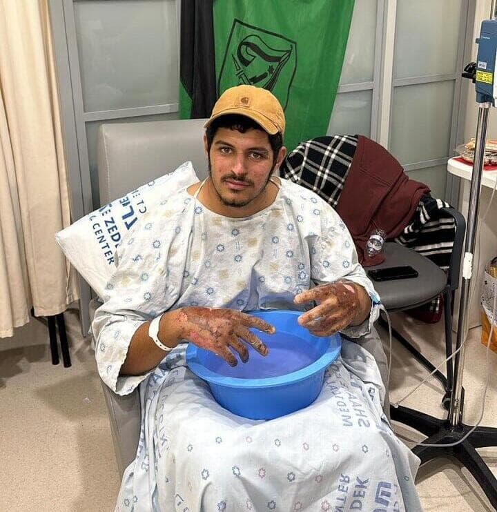 סער חמדי ב בית ה חולים מאושפז לאחר אחרי ה פציעה ש נפצע ב עזה ו אלון וולף הציל את חייו 