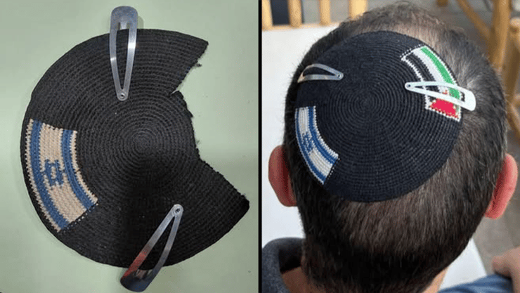 צילום: מתוך פייסבוק הכיפה שנגזרה על ידי שוטרים