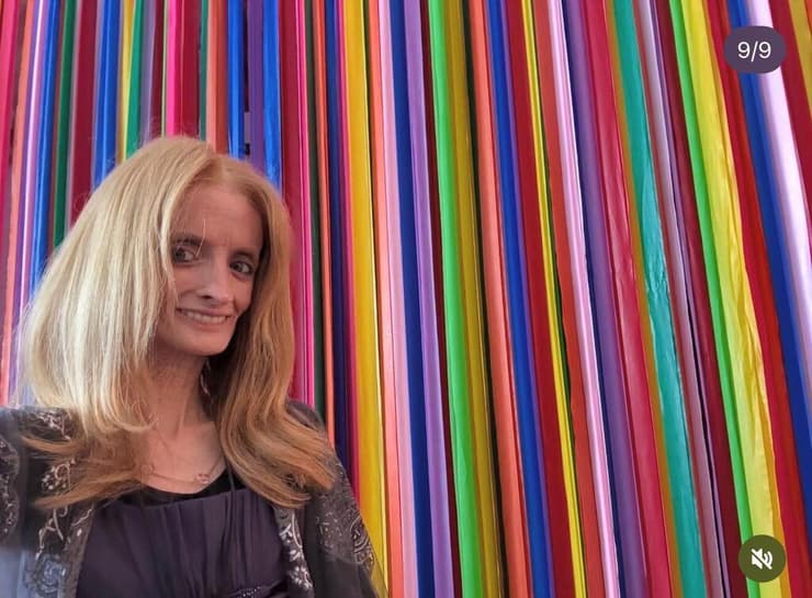 טיפאני וודקינד, הזדקנות מואצת, פרוגריה