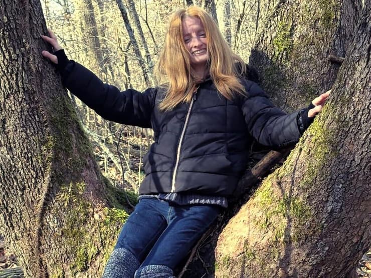 טיפאני וודקינד, הזדקנות מואצת, פרוגריה