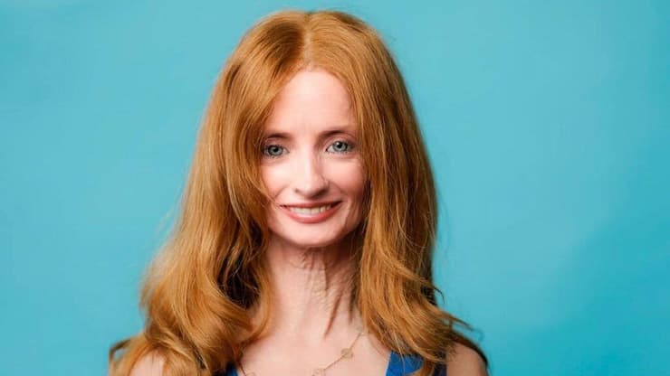 טיפאני וודקינד, הזדקנות מואצת, פרוגריה