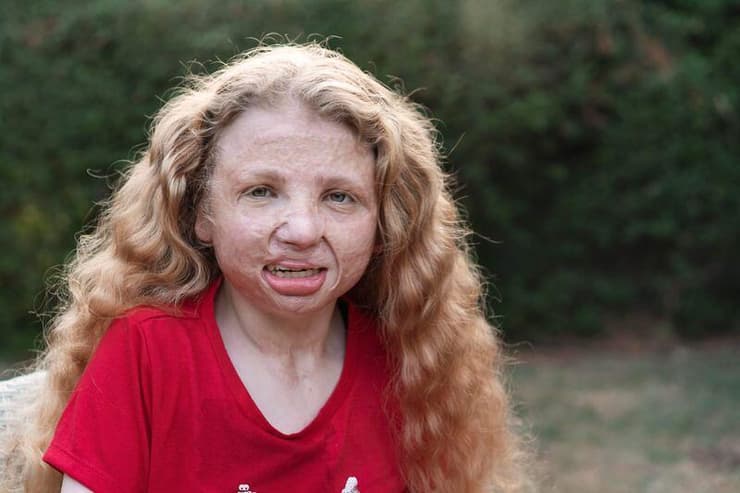 אלה פס. ילדה שמחה שזקוקה למקום משלה    