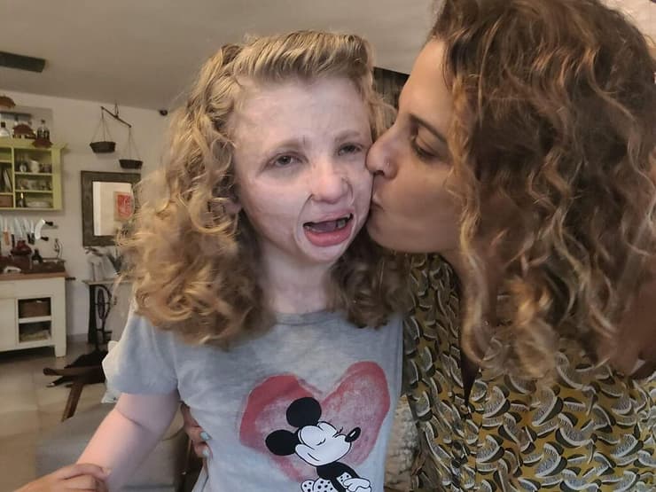 אורלי ואלה פס. "בשביל שאלה תיכנס למרכז ייעודי, מקבלת שירות אחרת צריכה למות"    