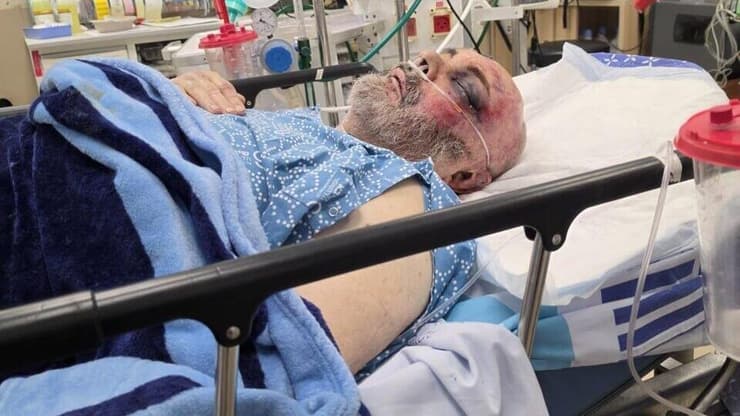 בוריס קוניק הנתקף מנשיכת הכלב באשדוד