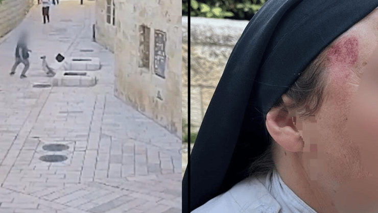 החשוד יונה שרייבר תוקף נזירה בירושלים פניה של הנזירה