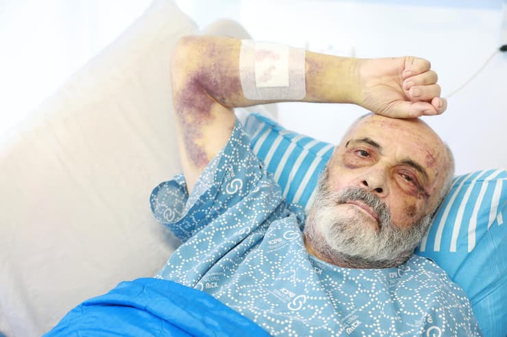 דרך ארוכה לשיקום. בוריס קוניק (צילום: דנה קופל) בוריס קוניק
