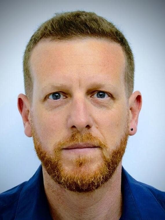 ד"ר מתן בירן, מומחה לכירורגיה של כף היד, שיבא