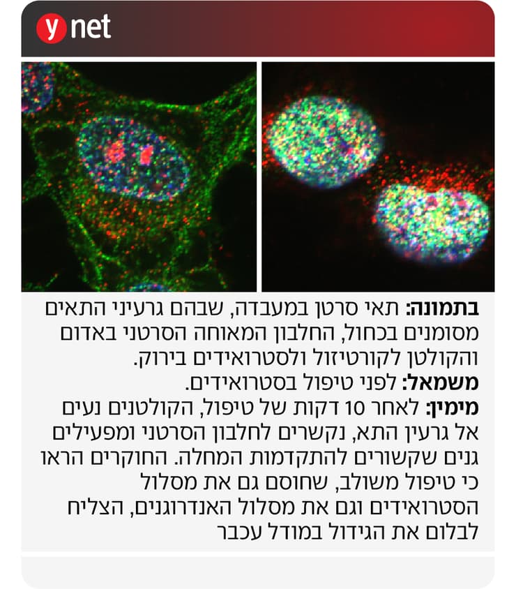 מחקר סרטן הערמונית מכון ויצמן