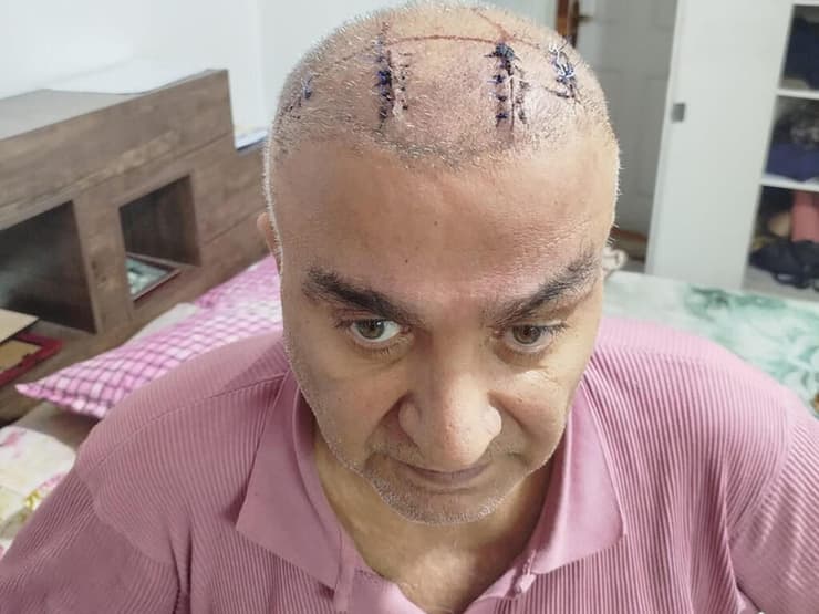 חמיד אספי. "מהלומות כבדות כוונו אל הצלעות, הכליות, הרקות והחלק האחורי של הראש שלי" (צילום: מתוך The Guardian) הסופר האיראני חמיד אספי שהוכה קשות בדירתו באיראן