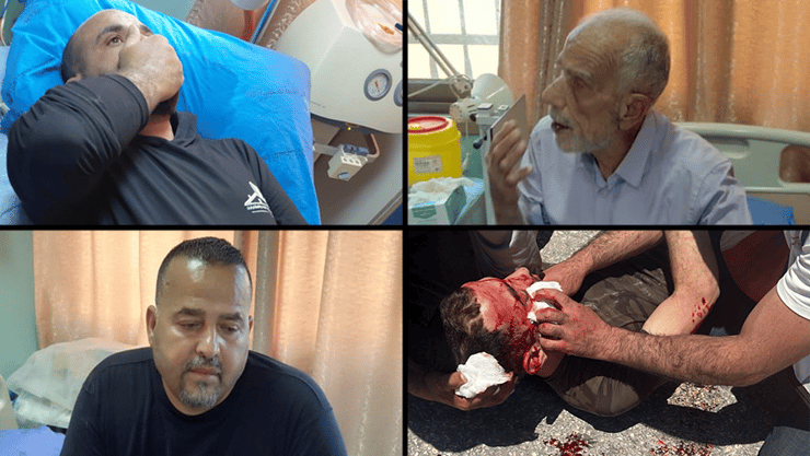 פלסטינים נפצעו מתקיפת מתנחלים בחווארה
