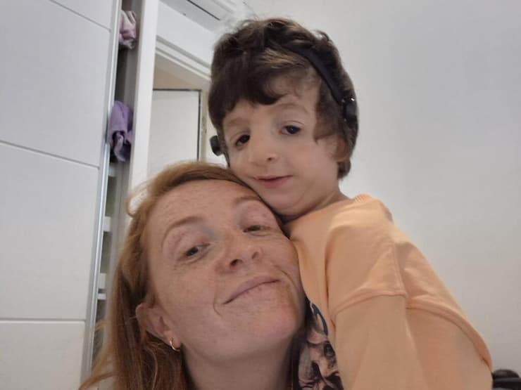 "אלה ילדים רגילים בלי אוזן או בלי שתי אוזניים". אדיר ודיאנה בר דיאנה בר אדיר בר תסמונת טריצ'ר קולינס