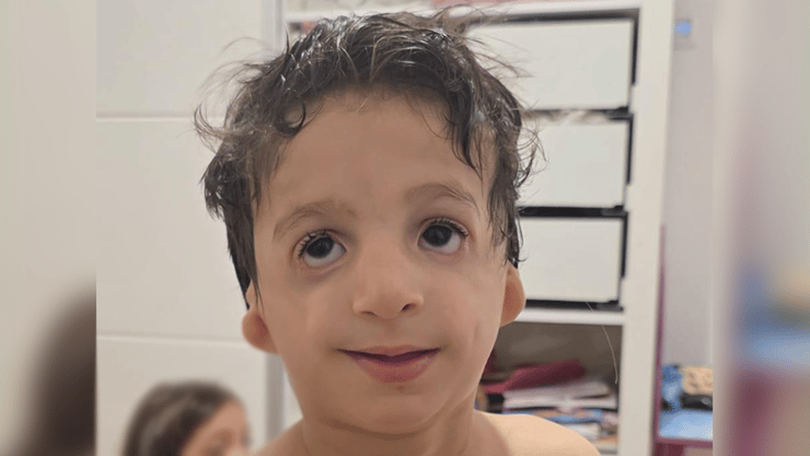 "אדירי היום ילד מתוק בטירוף. הוא חכם, הוא חברותי, הוא שובב, הוא מצחיק בטירוף" (צילום: באדיבות המשפחה) אדיר בר נולד עם תסמונת טריצ'ר קולינס
