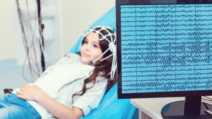 בדיקת EEG לאבחון אפילפסיה (צילום: shutterstock) בדיקת EEG לאבחון אפילפסיה