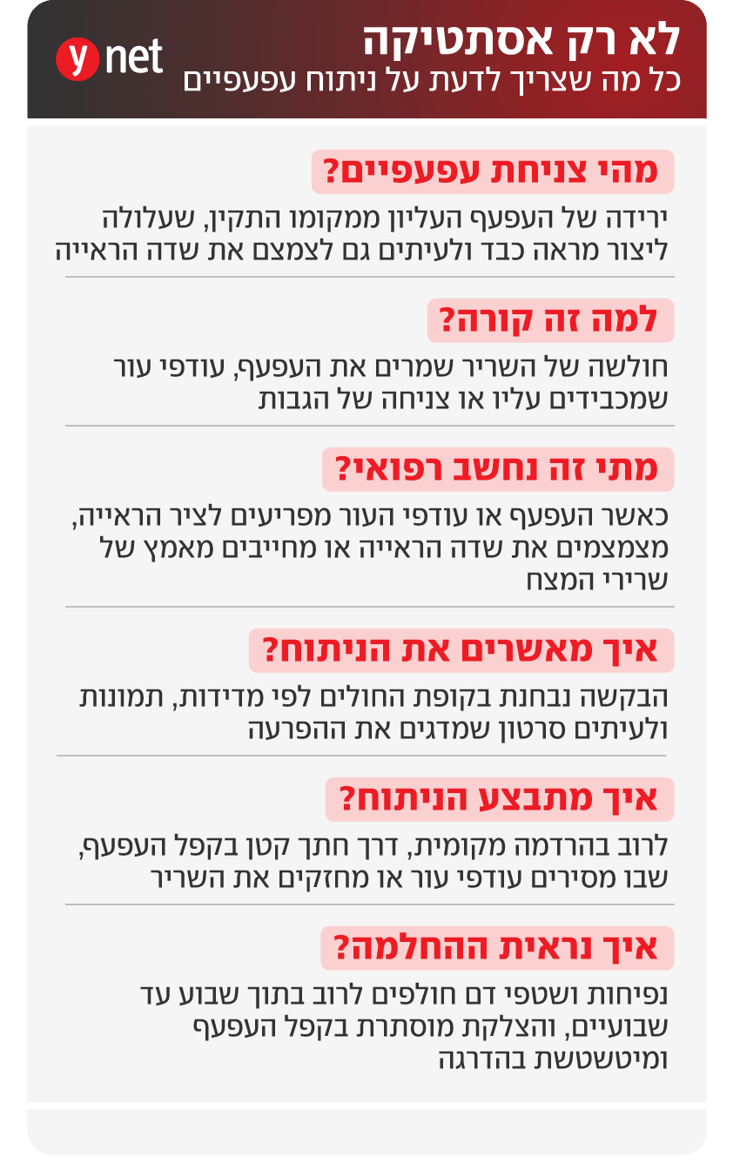 אינפו ניתוחי עפעפיים אינפו ניתוחי עפעפיים