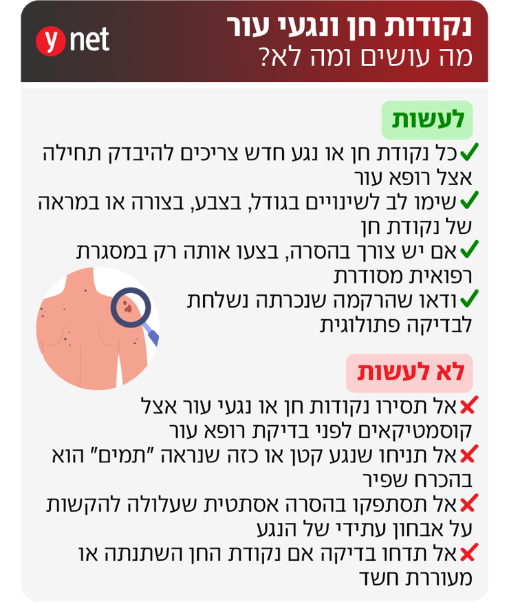 אינפו נגעים, עור, נקודת חן, נקודות חן, רופא עור