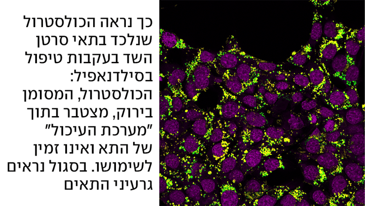 מחקר ויצמן גרורות ויאגרה הסבר