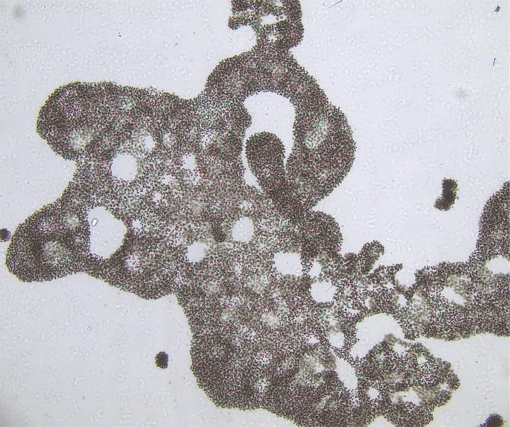 פריחת האצה Microcystis מתחת למיקרוסקופ