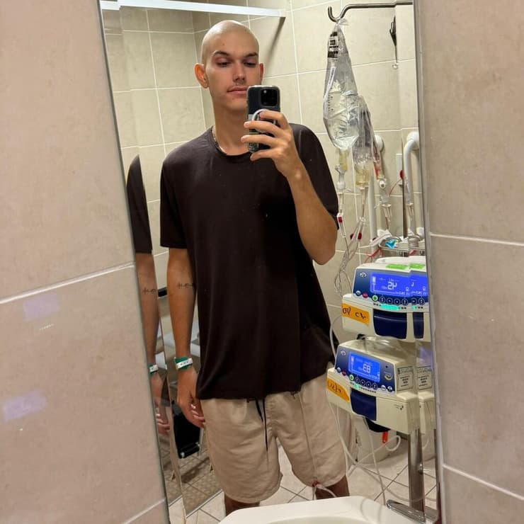 הפרידה מהשיער במהלך הטיפול האגרסיבי (צילום: אלבום פרטי) עומר אלון אובחן עם סרטן במהלך טיול גדול במזרח הרחוק
