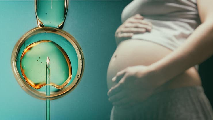 IVF