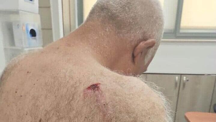 אפריים חלפלה הוכה ע"י חשודים שפלשו לשטחו