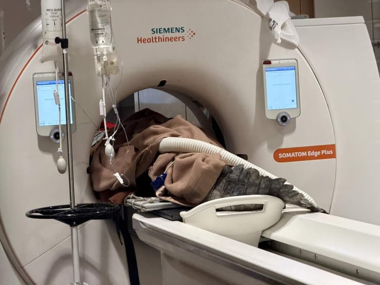 התנין ביל עובר סריקת CT