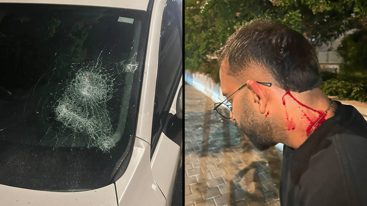 דוד אחרי התקיפה - והנזק לרכבו: "הגוף יחלים, אבל מה עם הנפש?" טוהר הותקף על ידי חבורת בנות באלות
