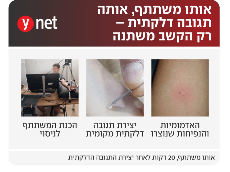 אינפו הפניית קשב לתחושת כאב