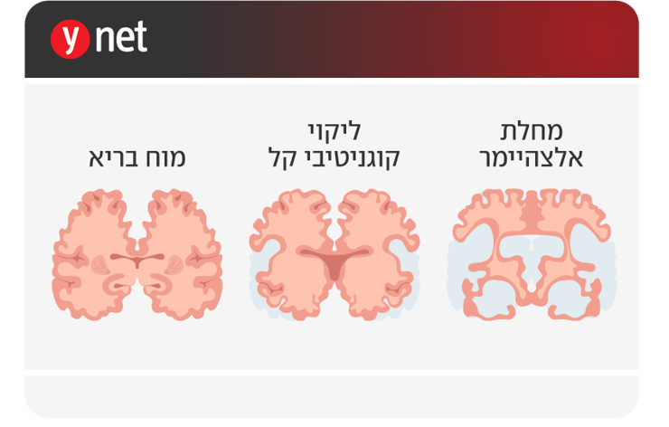 אינפו אינפו
